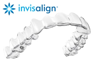 Clear Aligners Rockville Centre NY