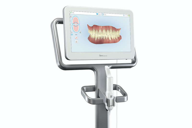 Digital dental scanning unit on a mobile stand | Dr. Doug Orthodontics