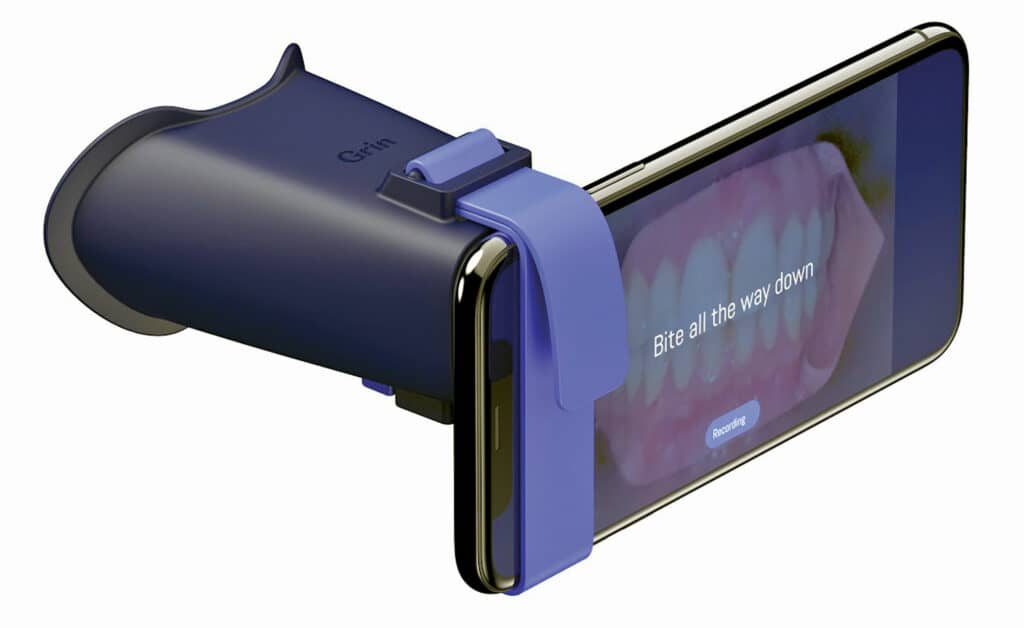 Side view of Grin remote dental scanning scope | Dr. Doug Orthodontics